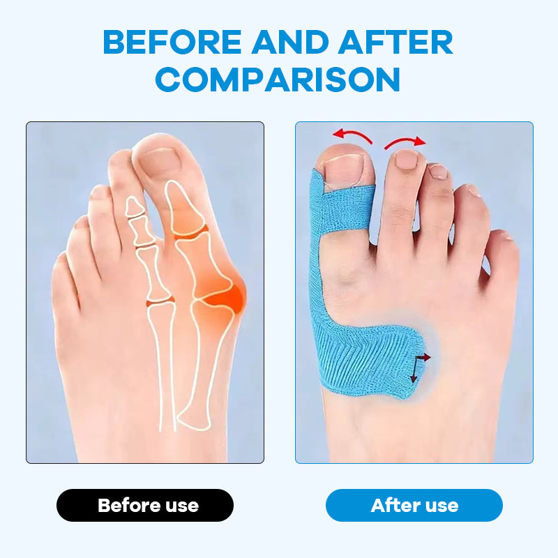 🔥Last Day 50% OFF🔥Pre-cut Bunion Corrector Kinesiology Tape