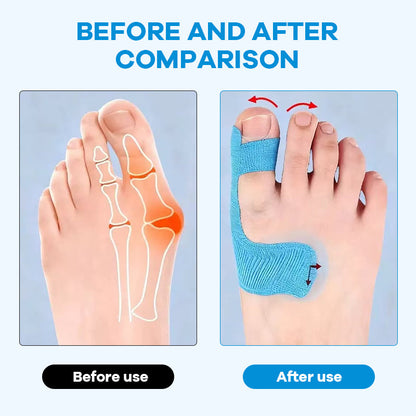 🔥Last Day 50% OFF🔥Pre-cut Bunion Corrector Kinesiology Tape